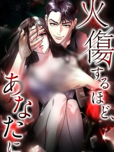 Burning for You - เปลวเพลิงแห่งรัก